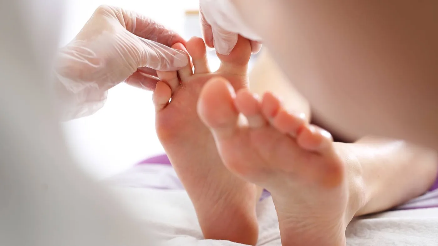 Athlete's foot treatment for active individuals